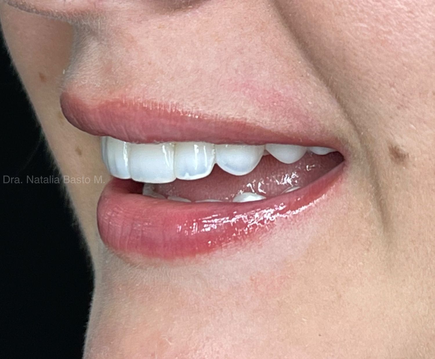 Recuperando su sonrisa después de años sin resultados