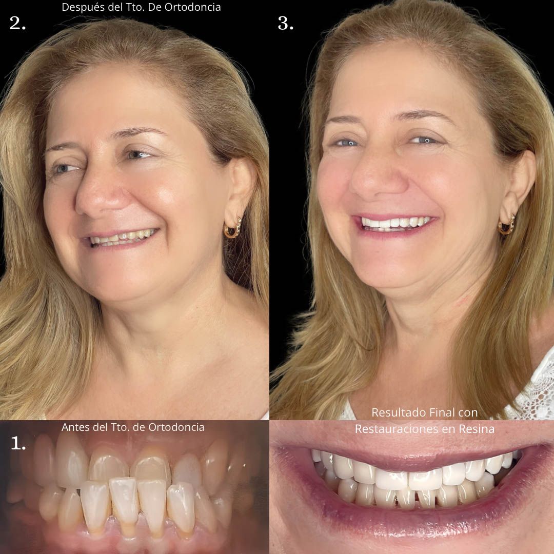 Recuperando su sonrisa después de años sin resultados