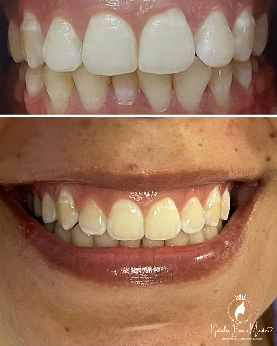 Dos nuevas sonrisas que hablan por sí solas