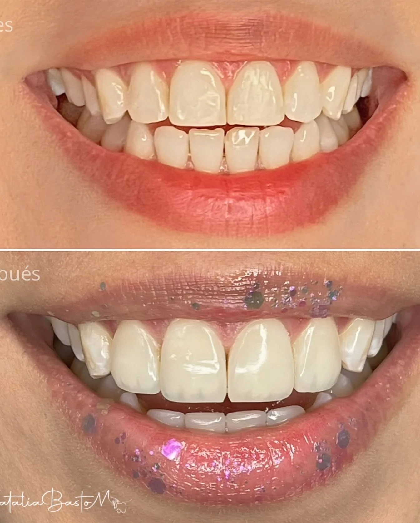 Dos nuevas sonrisas que hablan por sí solas