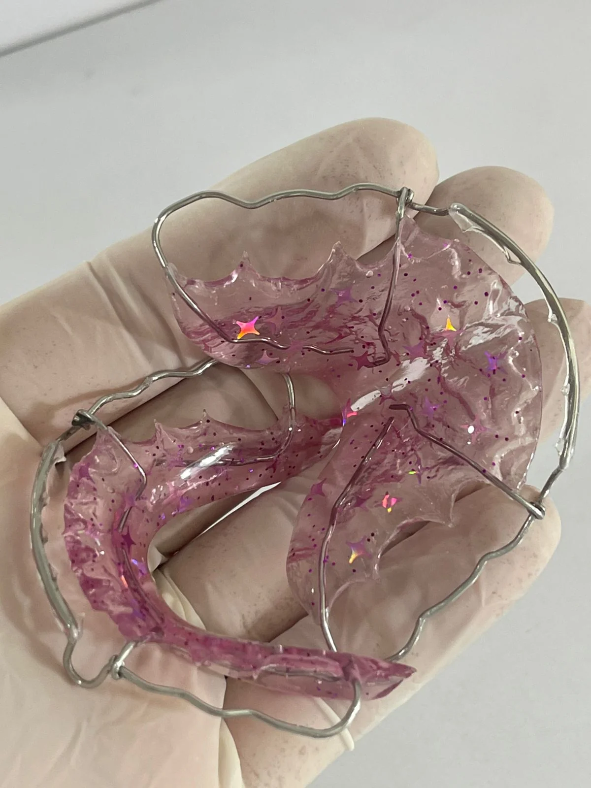 Ortodoncia en Adolescentes: Un Caso de Éxito que Refleja Disciplina y Sonrisas Personalizadas