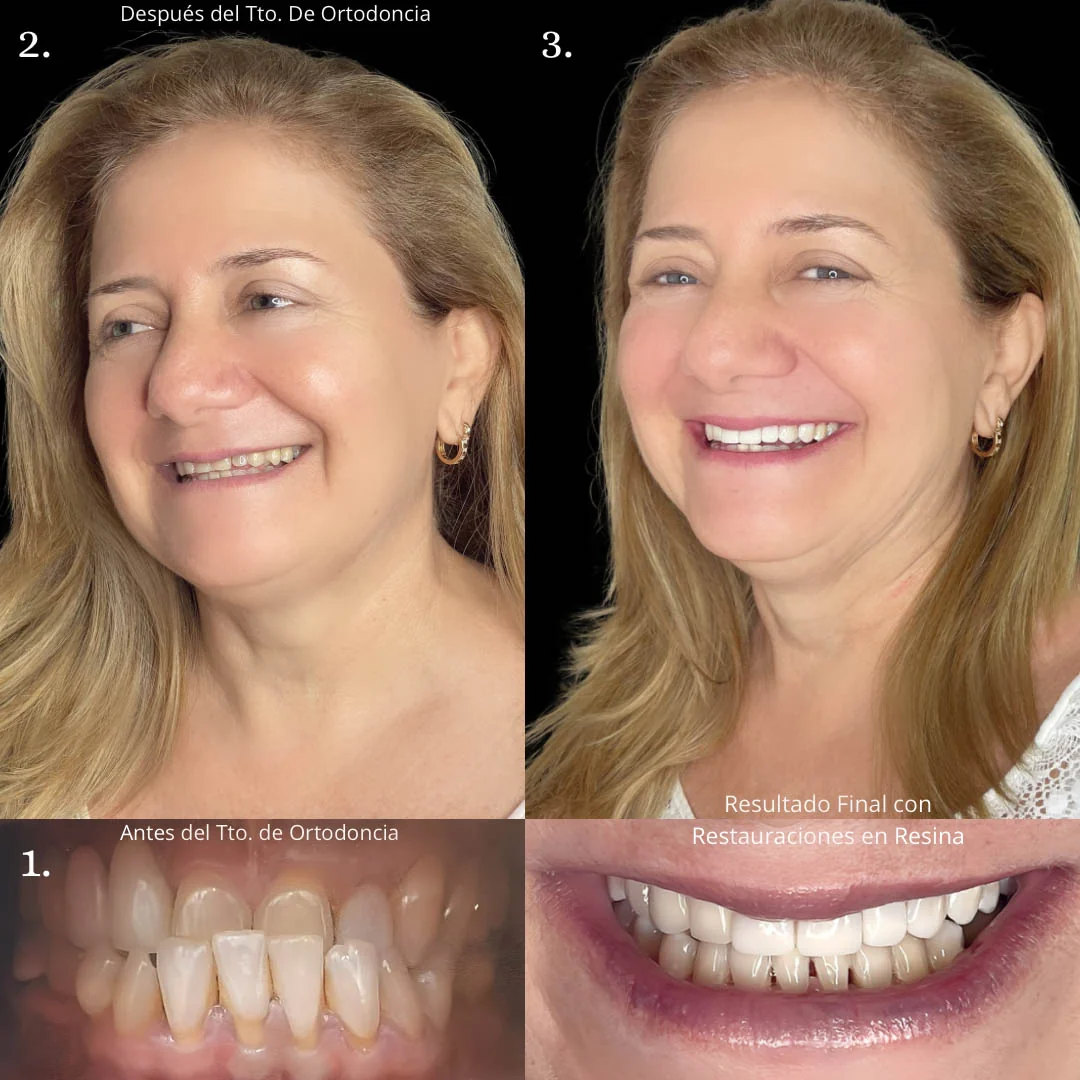 Recuperando su sonrisa después de años sin resultados