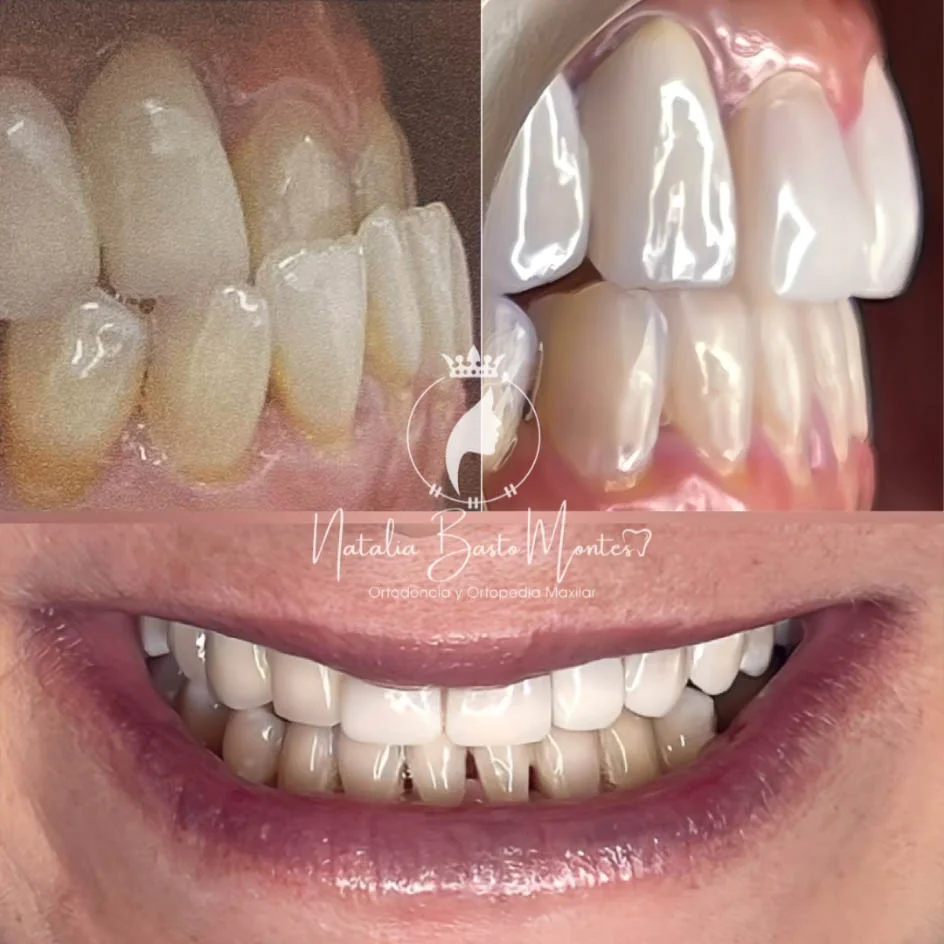 Recuperando su sonrisa después de años sin resultados