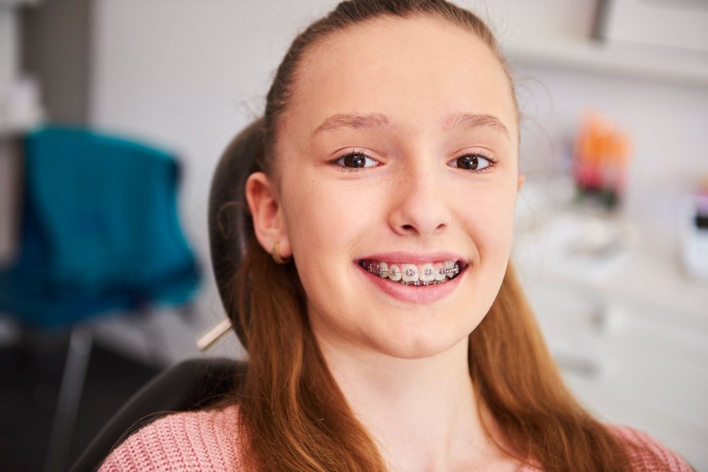 Estética Dental